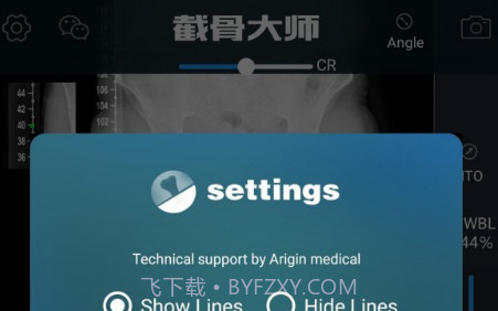 截骨大师V1.12截图