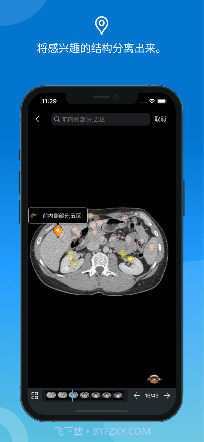 e-anatomy截图3 e-anatomy截图3