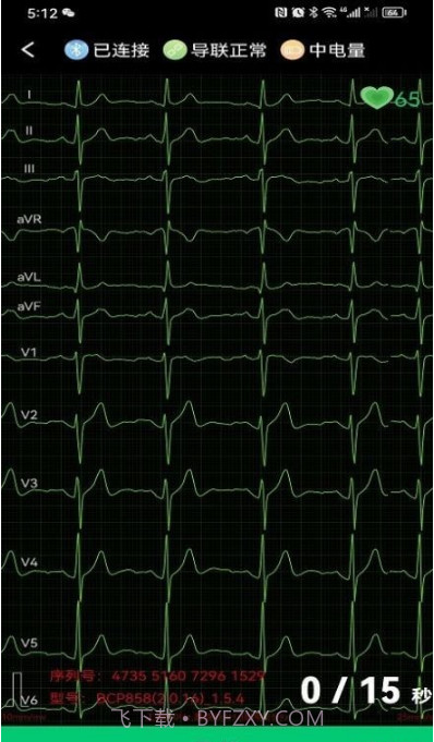 心电一张网截图2