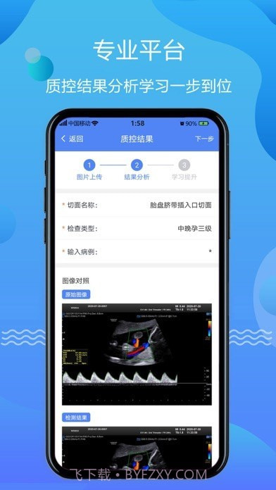超声智库截图3 超声智库截图3