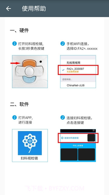 妇科视检镜截图2 妇科视检镜截图2