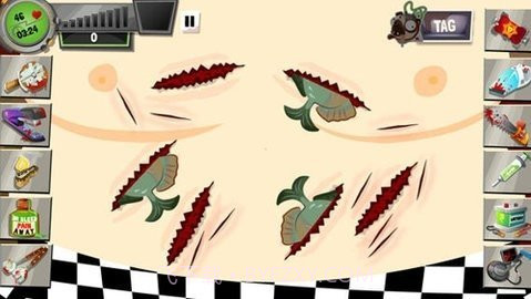 疯狂外科医生3截图2