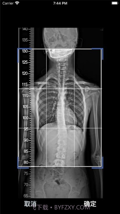 cobb角测量分析平台截图1
