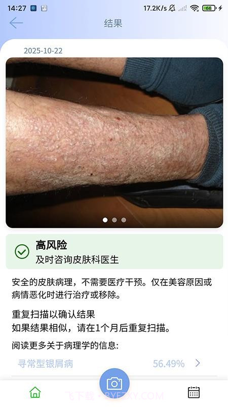 医用皮肤镜影像处理软件免费正版截图4