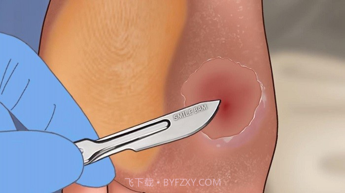修脚足疔模拟器测试版截图3